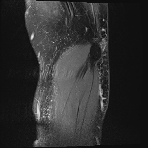 Click on the Serie image to view the images of Wieszt, Gnter